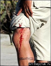 Фотограф был ранен в ногу около дома Бритни0photographerleg.jpg(Бритни Спирс, Britney Spears)